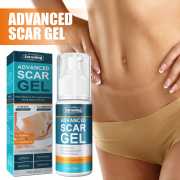 Jaysuing™ Scar Gel- স্ক্যাচ-দাগ দূরীকরণের (Advanced) (2 PCS)